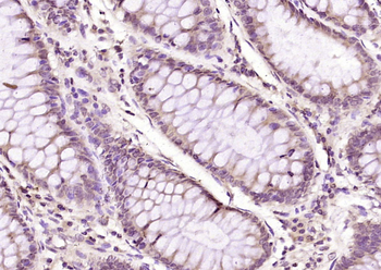 KAT3A / CBP Rabbit Polyclonal Antibody