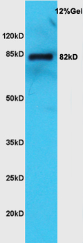 KCNN3 Rabbit Polyclonal Antibody