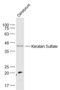 CHST1 Rabbit Polyclonal Antibody
