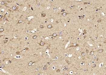 KIF1A Rabbit Polyclonal Antibody