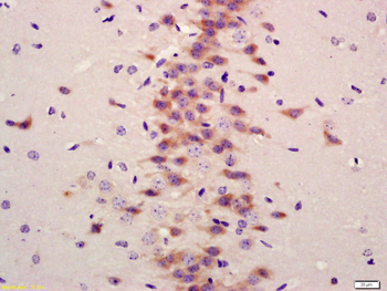 LC3A/B Rabbit Polyclonal Antibody