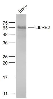 LILRB2 Rabbit Polyclonal Antibody
