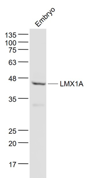 LMX1A Rabbit Polyclonal Antibody