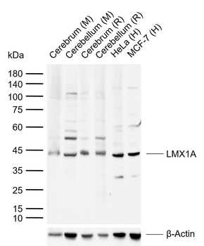 LMX1A Rabbit Polyclonal Antibody