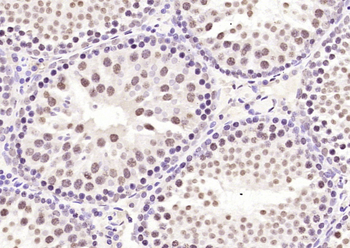LMX1b Rabbit Polyclonal Antibody