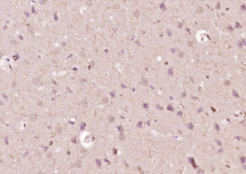 PLPPR1 Rabbit Polyclonal Antibody