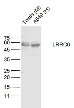 LRRC6 Rabbit Polyclonal Antibody