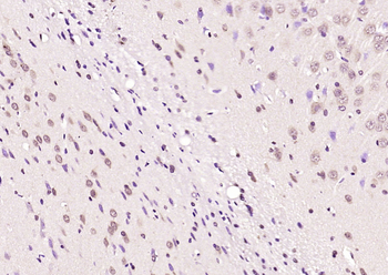 MAGI1 Rabbit Polyclonal Antibody