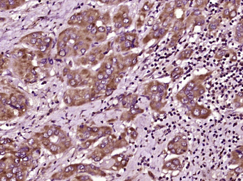 MAL2 Rabbit Polyclonal Antibody