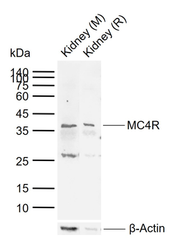 MC4R Rabbit Polyclonal Antibody