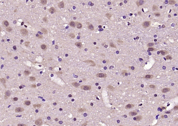 MEIS2 Rabbit Polyclonal Antibody