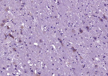 GRM1 Rabbit Polyclonal Antibody