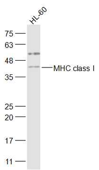 MHC class I Rabbit Polyclonal Antibody