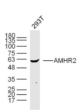 AMHR2 Rabbit Polyclonal Antibody
