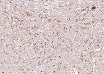 MLC1 Rabbit Polyclonal Antibody