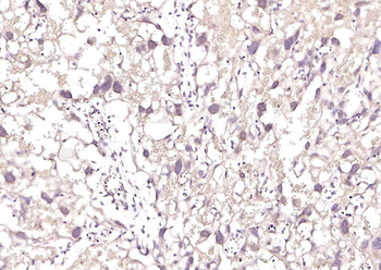 MLC1 Rabbit Polyclonal Antibody