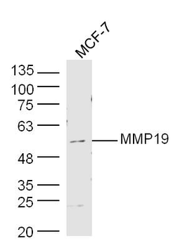 MMP19 Rabbit Polyclonal Antibody