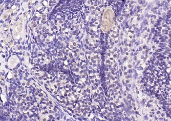 Mst2 Rabbit Polyclonal Antibody