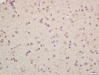 Musashi 1 Rabbit Polyclonal Antibody