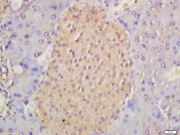 Musashi 1 Rabbit Polyclonal Antibody