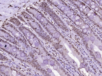 MYO6 Rabbit Polyclonal Antibody