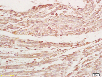 MYPN Rabbit Polyclonal Antibody