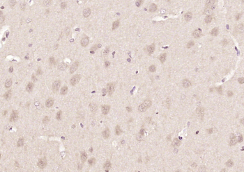 NAC1 Rabbit Polyclonal Antibody