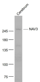 NAV3 Rabbit Polyclonal Antibody