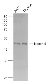 Nectin 4 Rabbit Polyclonal Antibody