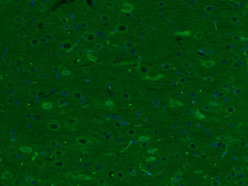 ChAT Rabbit Polyclonal Antibody (BF488)