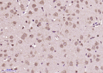 Netrin 5 Rabbit Polyclonal Antibody