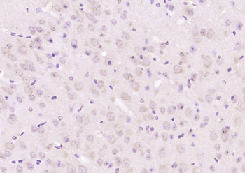 Neurabin 1 Rabbit Polyclonal Antibody