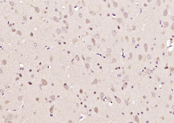 NEURL Rabbit Polyclonal Antibody
