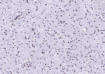 Neuro D Rabbit Polyclonal Antibody