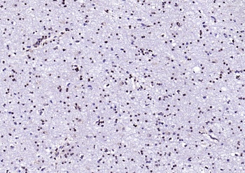 Neuro D4 antibody
