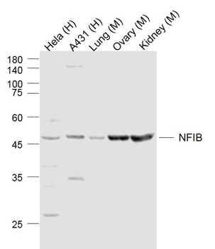 NFIB Rabbit Polyclonal Antibody