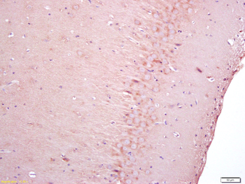 NGFR/p75NTR Rabbit Polyclonal Antibody