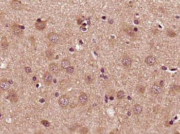 NR3B Rabbit Polyclonal Antibody