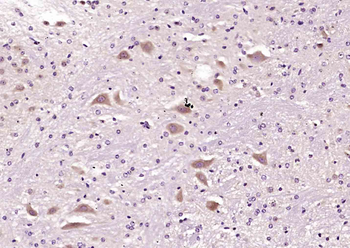 NME4 Rabbit Polyclonal Antibody