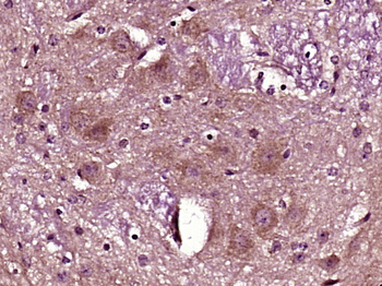 NMS Rabbit Polyclonal Antibody