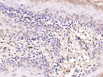 NOTCH1 Rabbit Polyclonal Antibody