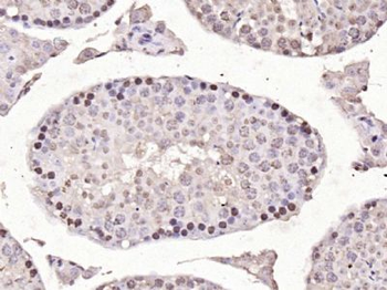 NOTCH1 Rabbit Polyclonal Antibody
