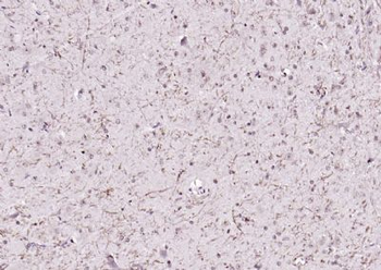 NOTCH1 Rabbit Polyclonal Antibody