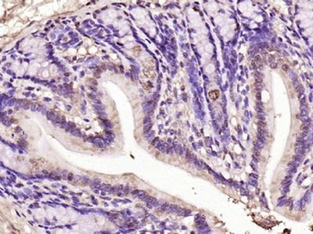 NOTCH1 Rabbit Polyclonal Antibody