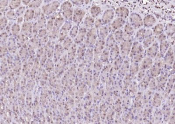 NOTCH1 Rabbit Polyclonal Antibody