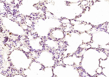 NR0B2 Rabbit Polyclonal Antibody