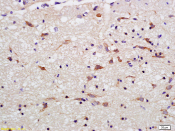 OPA1 Rabbit Polyclonal Antibody