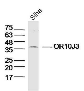 OR10J3 Rabbit Polyclonal Antibody