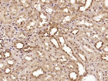 OSR1 + OSR2 Rabbit Polyclonal Antibody