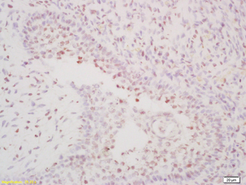 OSR1 + OSR2 Rabbit Polyclonal Antibody
